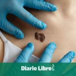 They warn about the silent advance of skin cancer in the country