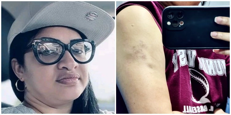 Activista cubana Yamilka Lafita, conocida como Lara Crofs