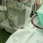 Un paciente recibiendo hemodiálisis en un hospital de Cuba