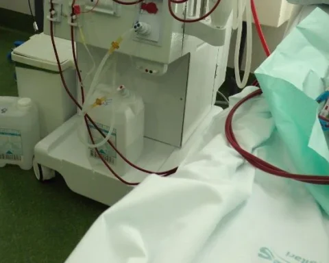 Un paciente recibiendo hemodiálisis en un hospital de Cuba