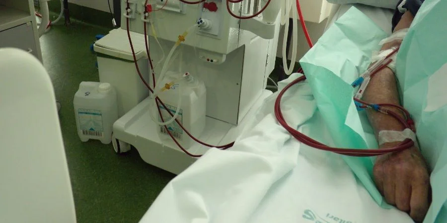Un paciente recibiendo hemodiálisis en un hospital de Cuba