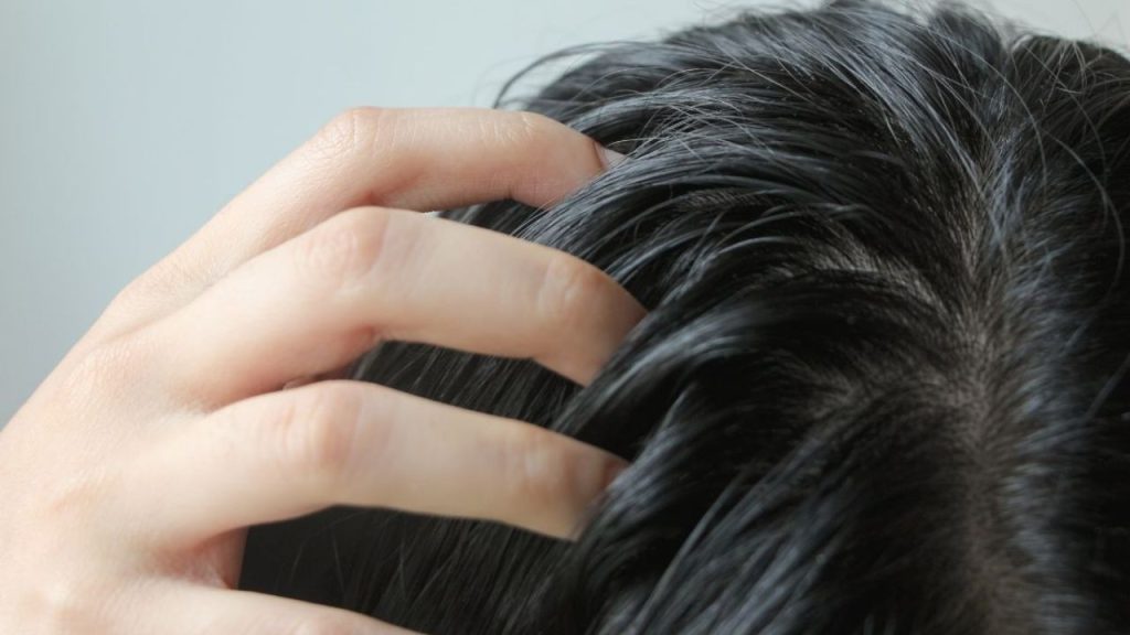 How to solve oily hair: 4 tricks