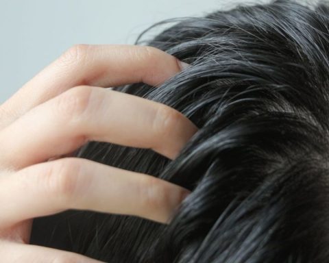 How to solve oily hair: 4 tricks