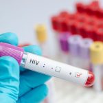 OPS aclara: VIH en República Dominicana no es nueva epidemia, aquí los detalles