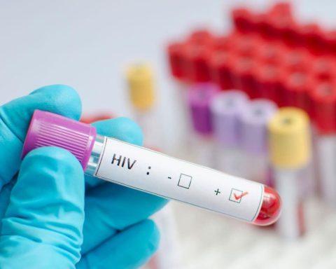 OPS aclara: VIH en República Dominicana no es nueva epidemia, aquí los detalles