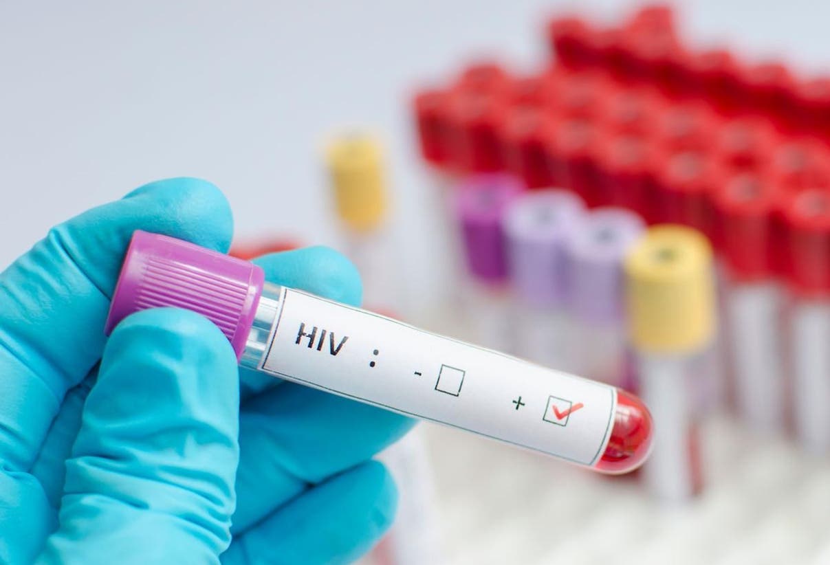 OPS aclara: VIH en República Dominicana no es nueva epidemia, aquí los detalles