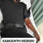 Sargento resulta herido en operativo que  fallecieron deliencuentes del caso artista Masha