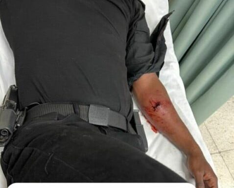 Sargento resulta herido en operativo que  fallecieron deliencuentes del caso artista Masha