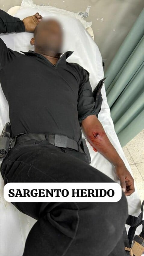Sargento resulta herido en operativo que  fallecieron deliencuentes del caso artista Masha