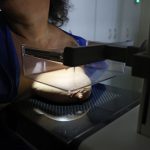 Vigitel: 92% of Brazilian women between 50 and 69 years old had a mammogram