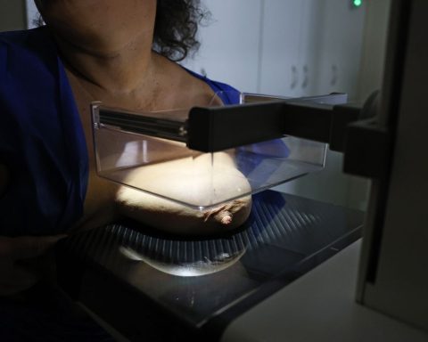 Vigitel: 92% of Brazilian women between 50 and 69 years old had a mammogram